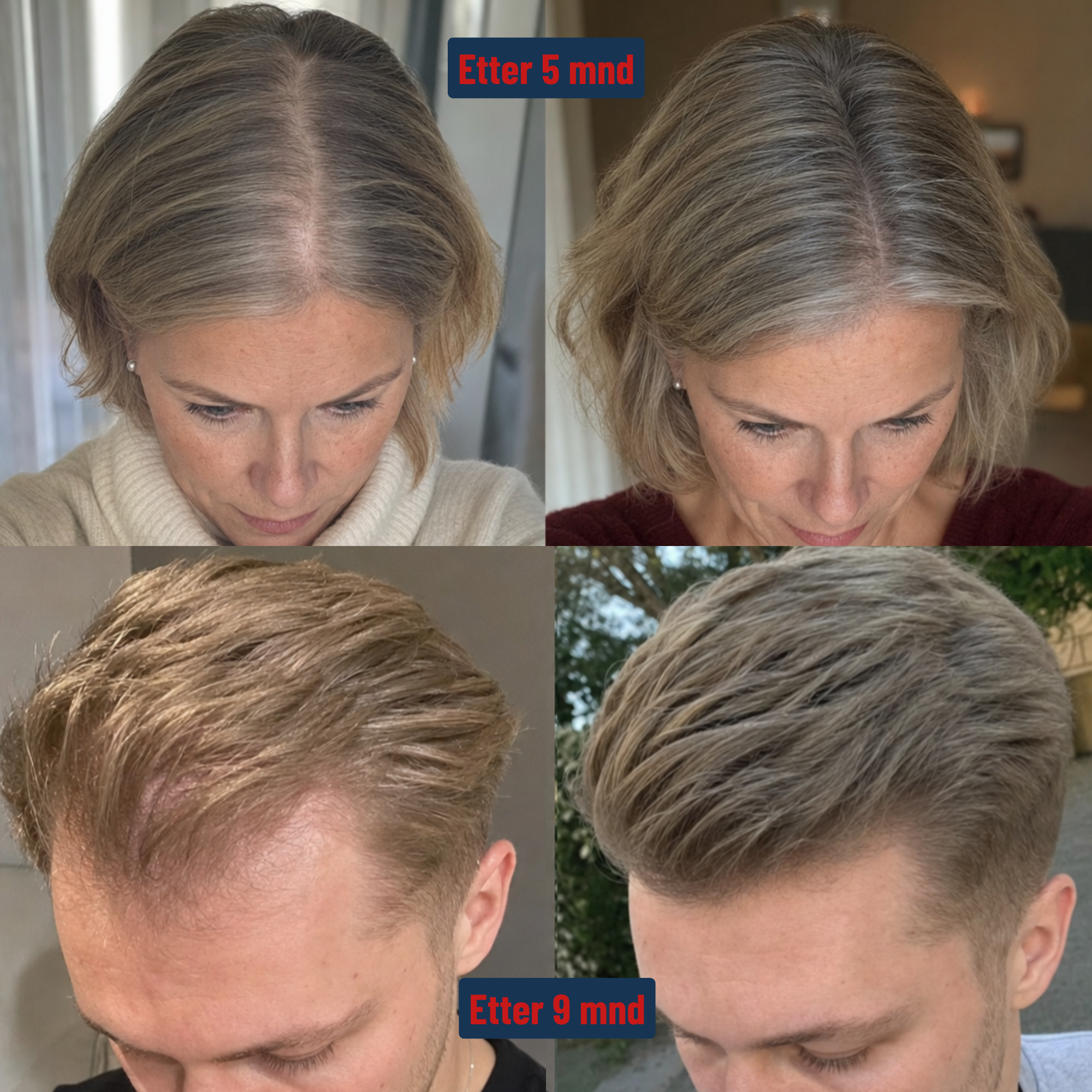 RødLys Caps